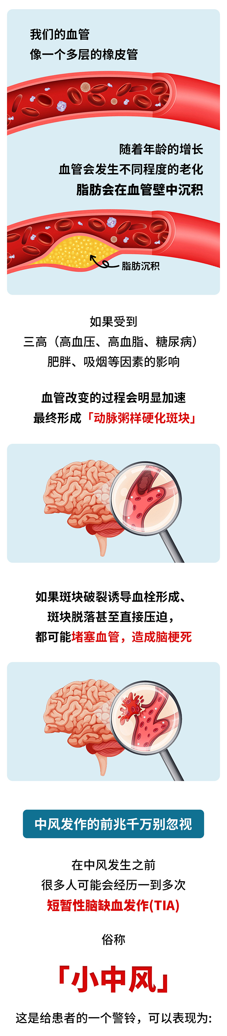 中風的5個前兆，盡早發(fā)現能救命_02.jpg
